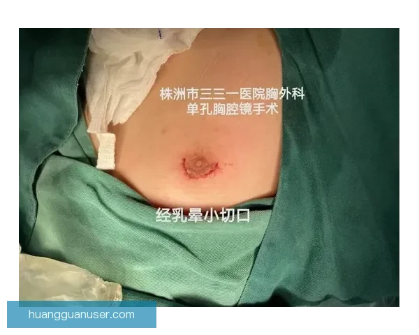 坎宁安气胸康复持续推进 活塞计划一周后复查评估