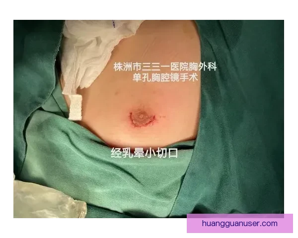 坎宁安气胸康复持续推进 活塞计划一周后复查评估