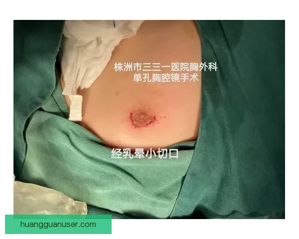 坎宁安气胸康复持续推进 活塞计划一周后复查评估