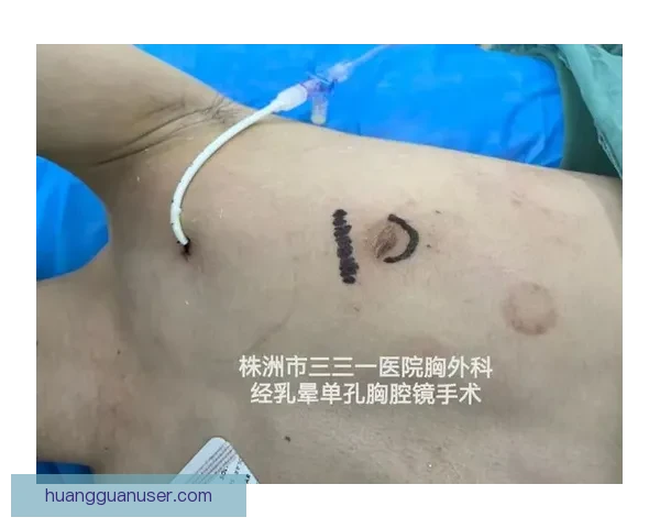 坎宁安气胸康复持续推进 活塞计划一周后复查评估